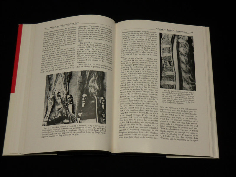 1962 CLINICAL ORTHOPAEDICS NO. 24 HARDCOVER BOOK BY ANTHONY DEPALMA - KD 6417