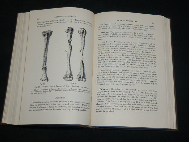 1948 HANDBOOK OF ORTHOPAEDIC SURGERY BOOK BY ALFRED RIVES SHANDS, M. D- KD 2765X