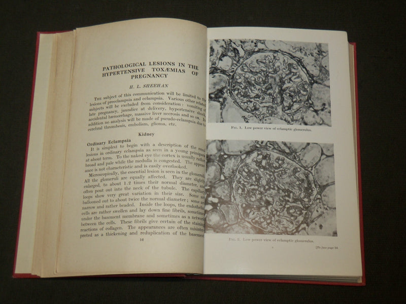 1950 TOXAEMIAS OF PREGNANCY - CIBA FOUNDATION SYMPOSIUM BOOK - KD 6115