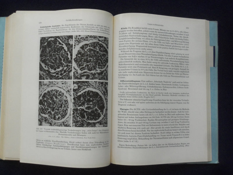 1958 NIERENKRANKHEITEN PHYSIOLOGIE HARDCOVER BOOK - HANS SARRE- GERMAN - KD 9004