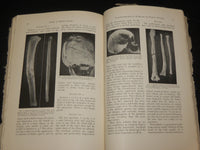 1932-1933 ANNALS OF MEDICAL HISTORY MAGAZINE LOT OF 3 ISSUES - WR 505F