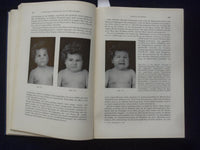 1961 DIE EIGENART DER KINDLICHEN HIRNTATIGKEIT HARDCOVER BOOK - GERMAN - KD 9005