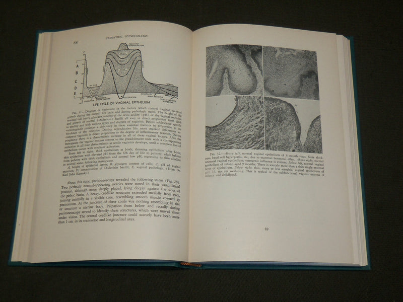 1953 PEDIATRIC GYNECOLOGY HARDCOVER BOOK BY GOODRICH C. SCHAUFFLER - KD 6114