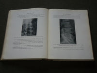 1929 ANNALS OF ROENTGENOLOGY VOLUME 8 - JAMES CASE - THE VERTEBRAE - KD 6218