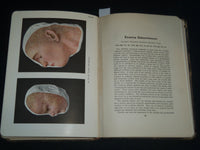 1913 PORTFOLIO OF DERMOCHROMES BY JEROME KINGSBURY VOLUMES 1-3 - KD 986