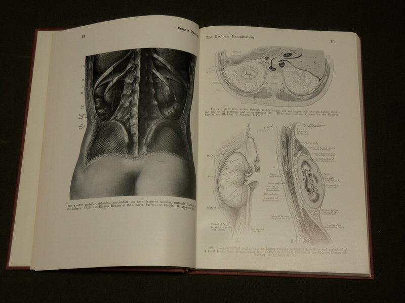 1969 FEMALE UROLOGY HARDCOVER BOOK BY DRS. RIDLEY & EVERETT - KD 6265