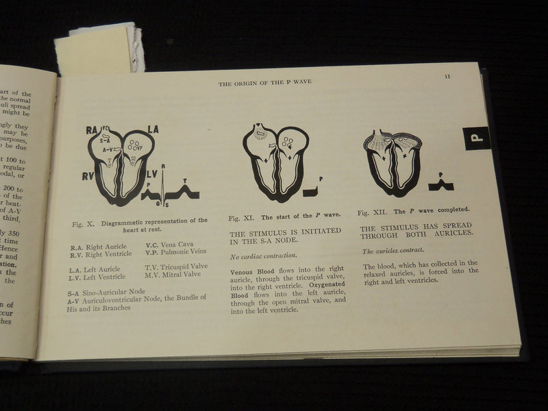 1952 P-Q-R-S-T ELECTROCARDIOGRAM GUIDE BOOK - RISEMAN - 3RD EDITION - K 2691