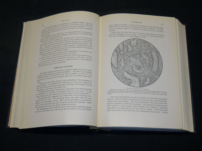 1916 GYNECOLOGY BOOK BY WILLIAM P. GRAVES M. D. - NICE ILLUSTRATIONS - KD 2755X