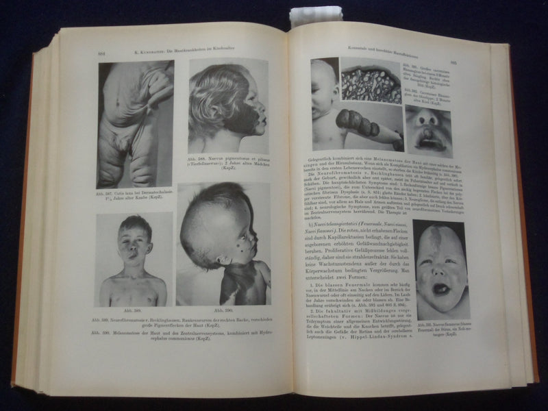 1961 LEHRBUCH DER PADIATRIE HARDCOVER BOOK - GERMAN TEXT - KD 8990