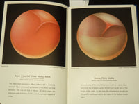 1946 AN AURAL ATLAS - AURALGAN RESEARCH DIV. RED CROSS BOOK - 49 PLATES- KD 9515