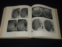 1916 JOHNS HOPKINS HOSPITAL BULLETIN BOUND VOLUME NO. 27 - KD 5403K
