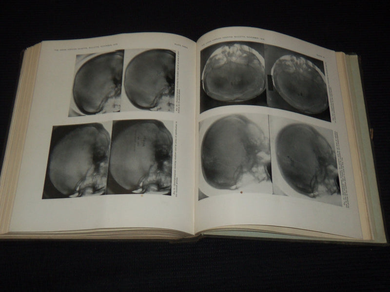 1916 JOHNS HOPKINS HOSPITAL BULLETIN BOUND VOLUME NO. 27 - KD 5403K