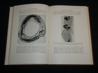 1942 VASCULAR SCLEROSIS HARDCOVER BOOK BY ELI MOSCHCOWITZ - KD 7193