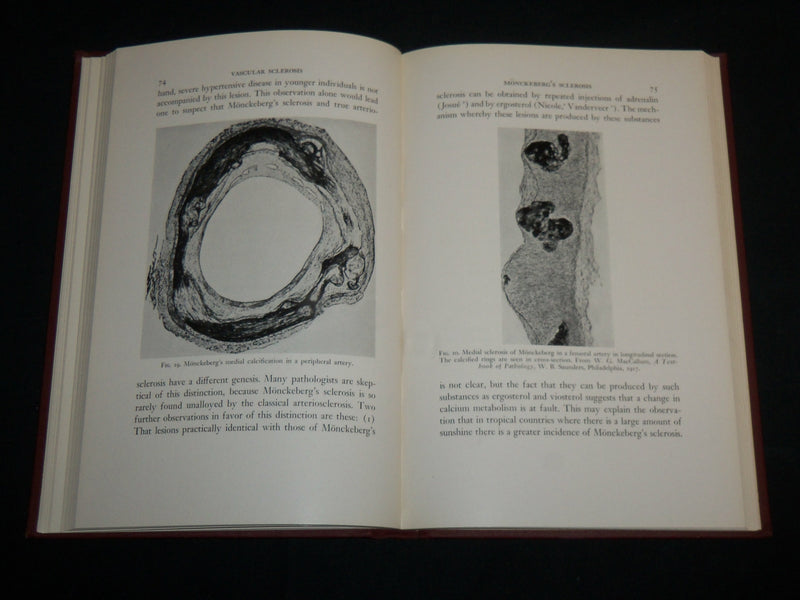 1942 VASCULAR SCLEROSIS HARDCOVER BOOK BY ELI MOSCHCOWITZ - KD 7193