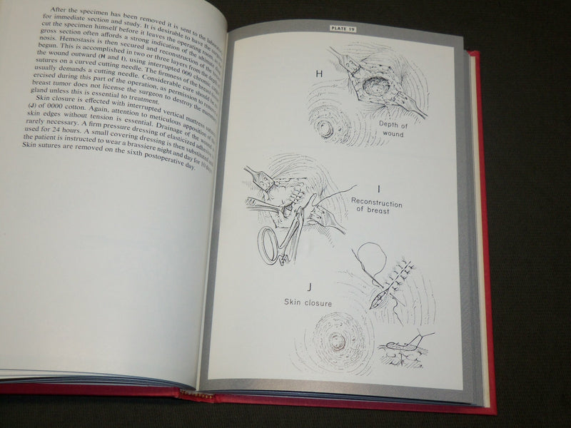 1968 SURGERY OF THE BREAST BOOK BY SOUTHWICK SLAUGHTER & HUMPHREY- KD 6073