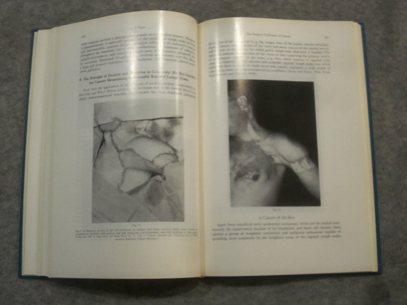 1967 NEW TRENDS IN THE TREATMENT OF CANCER EDITED BY L. MANUILA - KD 2759M
