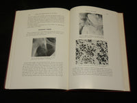 1958 INJURIES AND SURGICAL DISEASES OF THE ISCHIUM BOOK HENRY MILCH - KD 2768L