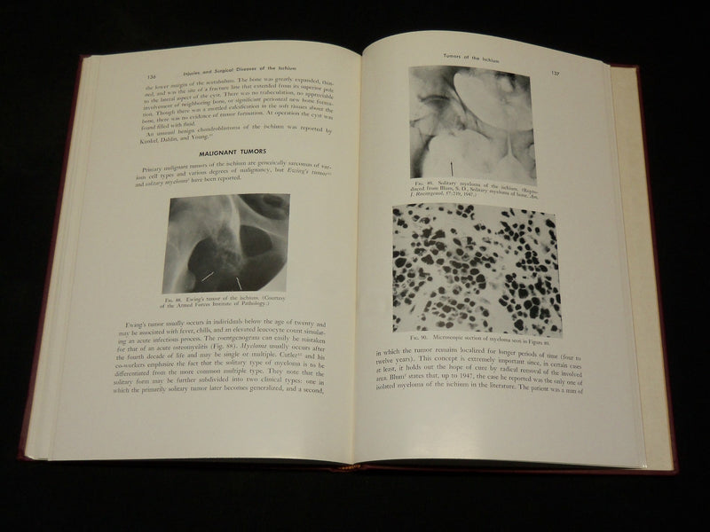 1958 INJURIES AND SURGICAL DISEASES OF THE ISCHIUM BOOK HENRY MILCH - KD 2768L