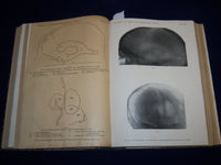 1921-1922 FORTSCHRITLE AUF DEMGEBIETE DER RONTGENSTRAHLEN VOLUME - KD 2951P