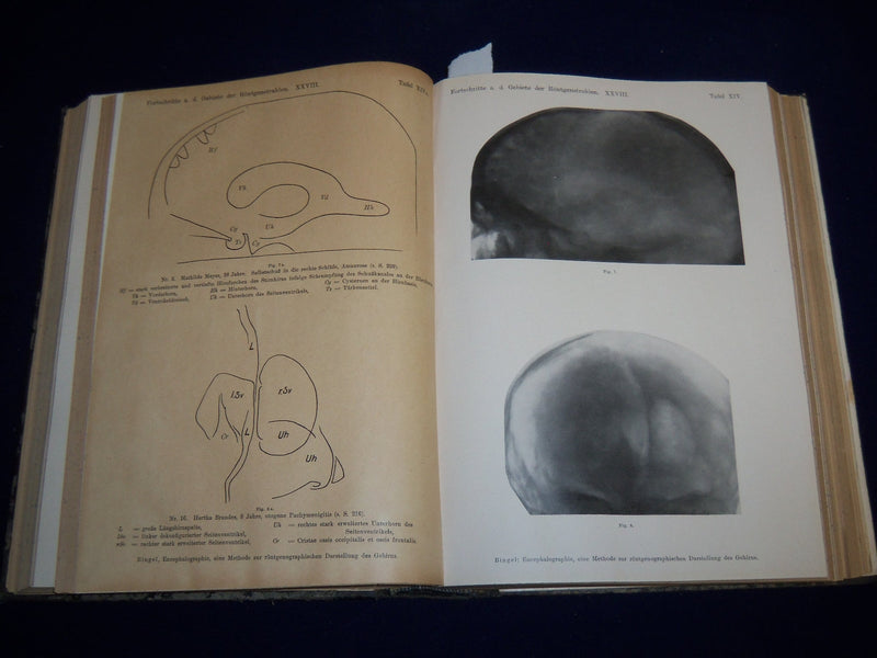 1921-1922 FORTSCHRITLE AUF DEMGEBIETE DER RONTGENSTRAHLEN VOLUME - KD 2951P