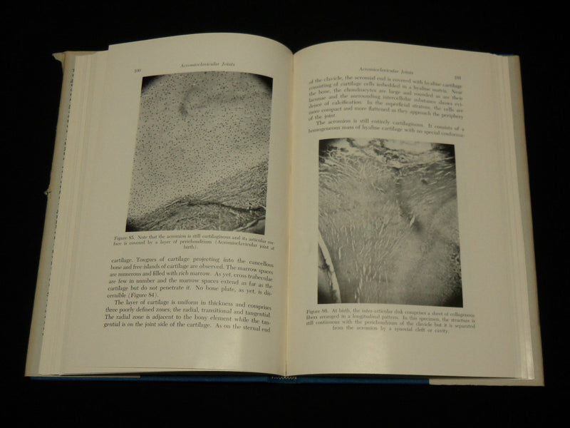 1957 DEGENERATIVE CHANGES IN THE STERNOCLAVICULAR JOINTS BOOK DEPALMA - KD 6362