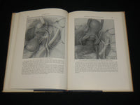 1954 HYSTERECTOMY HARDCOVER BOOK BY DR. BURCH AND DR. LAVELY - KD 6367