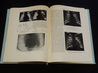 1957 RETRO PNEUMOPERITONEUM UND PPNEUMOMEDIASTINUM VON UMBERTO COCCHI - KD 5981J