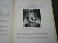 1929 ANNALS OF ROENTGENOLOGY VOLUME 8 - JAMES CASE - THE VERTEBRAE - KD 6218