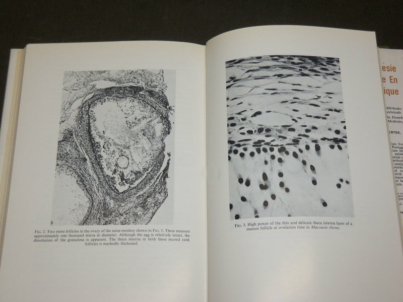 1961 CONTROL OF OVULATION HARDCOVER BOOK EDITED BY CLAUDE A. VILLEE - KD 6293