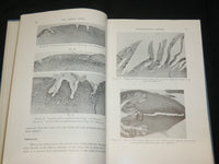 1961 THE CERVIX UTERI AND ITS DISEASES BOOK BY FREDERIC FLUHMANN M. D.- KD 2761C