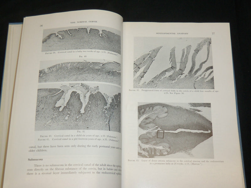 1961 THE CERVIX UTERI AND ITS DISEASES BOOK BY FREDERIC FLUHMANN M. D.- KD 2761C