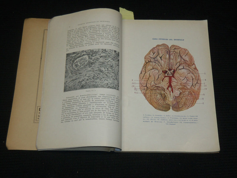 1927-1935 ARCHIVES ARGENTINOS DE NEUROLOGIA SPANISH MAGAZINES LOT OF 5 - WR 505E