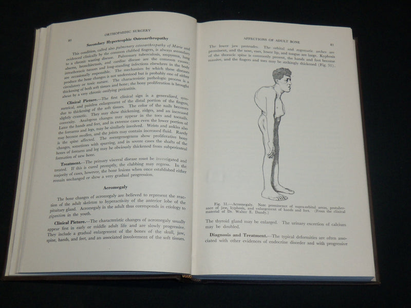 1948 HANDBOOK OF ORTHOPAEDIC SURGERY BOOK BY ALFRED RIVES SHANDS, M. D- KD 2765X