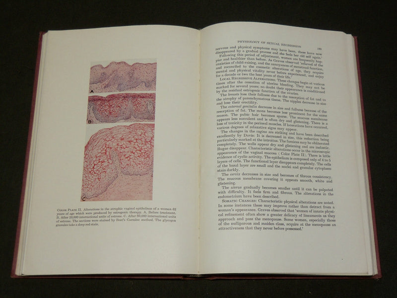 1939 ENDOCRINE GYNECOLOGY BOOK BY E. C. HAMBLEN, M. D. - KD 6134