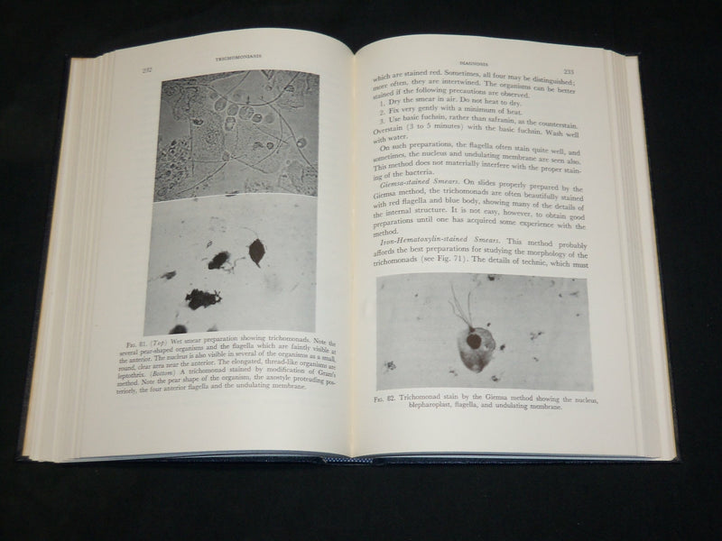 1953 VAGINAL INFECTIONS INFESTATIONS AND DISCHARGES BOOK BY BERNSTINE - KD 2761K