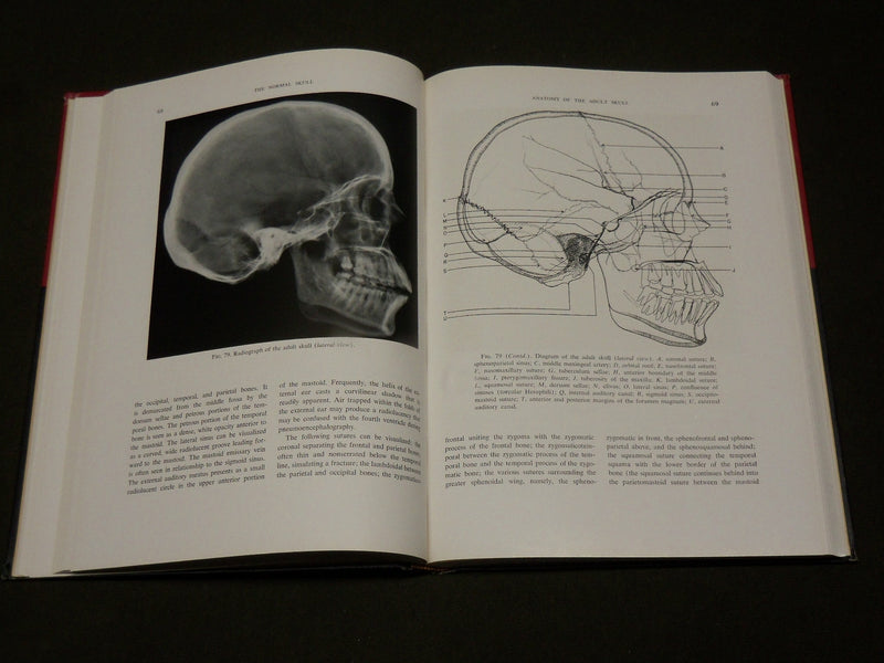 1960 THE NORMAL SKULL A ROENTGEN STUDY BOOK BY SHAPIRO & JANSEN - KD 6294