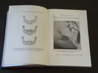 1936 CLINICAL DIAGNOSIS OF DISEASES OF THE MOUTH BY LOUIS V. HAYES - KD 3996