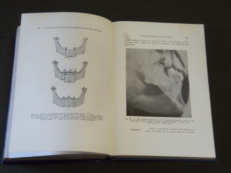 1936 CLINICAL DIAGNOSIS OF DISEASES OF THE MOUTH BY LOUIS V. HAYES - KD 3996