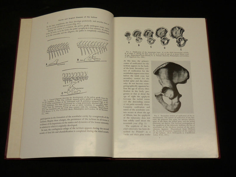 1958 INJURIES AND SURGICAL DISEASES OF THE ISCHIUM BOOK HENRY MILCH - KD 2768L