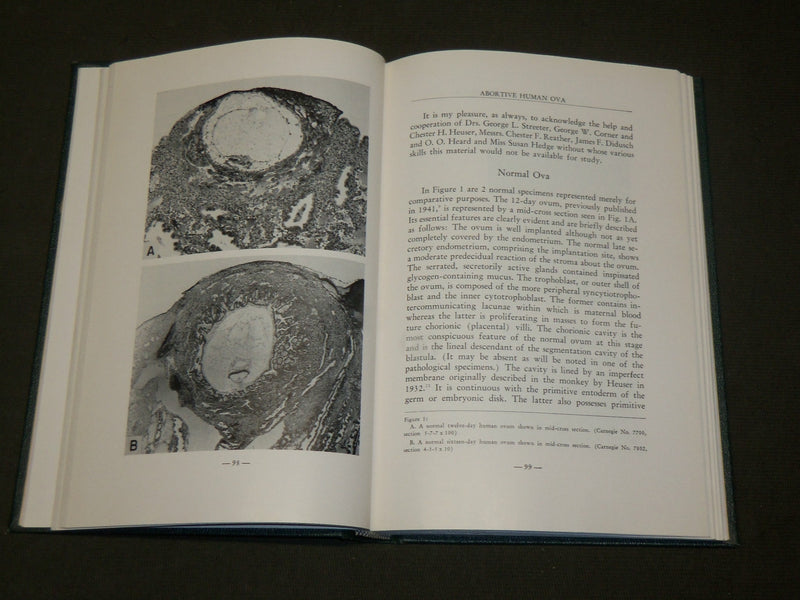 1950 MENSTRUATION AND ITS DISORDERS BOOK EDITED BY EARL T. ENGLE - KD 6121