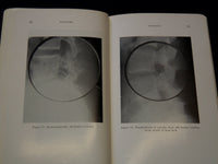 1955 BACKACHE SOFTCOVER BOOK BY FRANK R. OBER MD - KD 7664