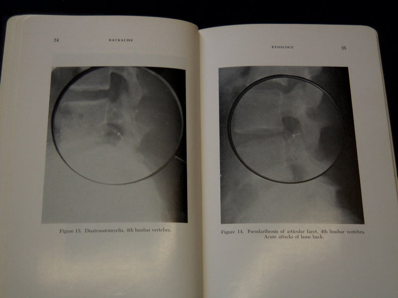 1955 BACKACHE SOFTCOVER BOOK BY FRANK R. OBER MD - KD 7664