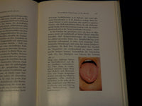 1960 VERANDERUNGEN DER ZUNGE IN DER DIAGNOSTIK ARZTES BOOK BY JACOBY - J 9560