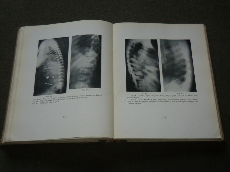 1929 ANNALS OF ROENTGENOLOGY VOLUME 8 - JAMES CASE - THE VERTEBRAE - KD 6218