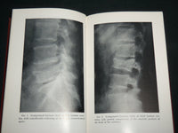 1954 LOW BACK PAIN AND SCIATICA HARDCOVER BOOK BY LOUIS T. PALUMBO - KD 7223