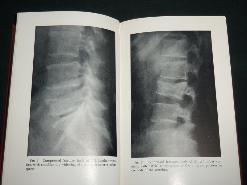1954 LOW BACK PAIN AND SCIATICA HARDCOVER BOOK BY LOUIS T. PALUMBO - KD 7223