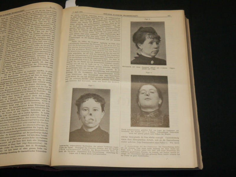 1902 JAN-DEC BERLINER KLINISCHE WOCHENSCHRIFT MAGAZINE BOUND VOLUME - R 491