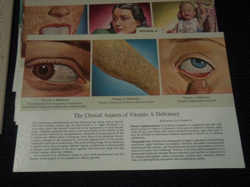 1947 VITAMINS AND CLINICAL CASE MANAGEMENT BY LEDERLE LABORATORIES - KD 3350C