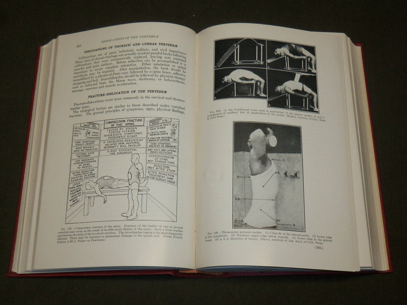 1955 THE BACK AND ITS DISK SYNDROMES BOOK BY PHILIP LEWIN M. D. - KD 6288