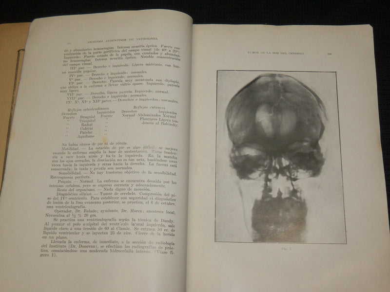 1927-1935 ARCHIVES ARGENTINOS DE NEUROLOGIA SPANISH MAGAZINES LOT OF 5 - WR 505E